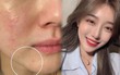 6 chai toner đặc trị ai dùng cũng khen: Loại làm lỗ chân lông nhỏ tí, loại làm sáng da mờ thâm lợi hại
