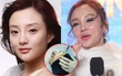 Sự thật về những mũi tiêm filler 
