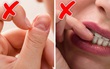 Thói quen cắn móng tay: Tưởng chỉ là tật xấu từ hồi bé nhưng thật ra tiết lộ rất nhiều điều về tâm lý mà ít ai ngờ tới