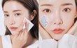 Cảnh báo mùa nồm: Bác sĩ khuyên nàng da dầu phải tránh tiệt 4 sản phẩm này kẻo da lúc nào cũng như 