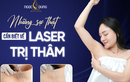Sự thật về laser trị thâm: Điều bạn cần biết trước khi điều trị