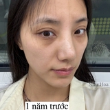 Tôi lấy lại làn da tuổi 20 nhờ 1 năm ngủ sớm, ăn lành và chăm da đúng cách