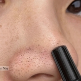 Ở tuổi 27, tôi học được cách làm sạch mụn đầu đen ở mũi hiệu quả, làm 1 lần là "nhẵn thín"