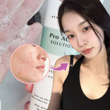 Top 7 sữa rửa mặt cho da dầu mụn, giá bình dân nhưng dùng phải thốt lên là ĐỈNH!