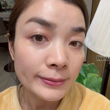 Ngoài 40 tuổi, tôi đã tìm ra cách "cải lão hoàn đồng", giúp da từ tổn thương tới khỏe đẹp mịn căng