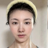 44 tuổi, tôi trị nám thành công nhờ thay đổi 6 thói quen và nhận ra rằng không phải cứ bôi nhiều là tốt