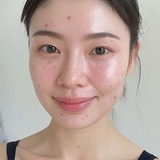 Sáng thức dậy làm 5 việc này, da dẻ đẹp lên từng ngày, nếp nhăn khó mà xuất hiện