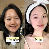 Làm 5 việc này khi đi ngủ, làn da của tôi như "thay da đổi thịt" hoàn toàn