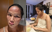 Chuyện gì xảy ra với H'Hen Niê sau khi xuất hiện với gương mặt khác lạ