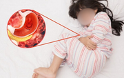 Bé trai 12 tuổi xuất huyết tiêu hóa, 3 tháng nhập viện 2 lần vì loại vi khuẩn 70% dân số Việt Nam nhiễm