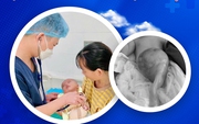 Hành trình 71 ngày giành lại sự sống cho trẻ sơ sinh mang khối thoát vị rốn "khổng lồ"