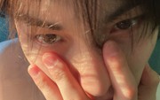 4 thay đổi ở đôi mắt là GƯƠNG PHẢN CHIẾU cả tá bệnh ung thư, tiếc là ít ai để ý