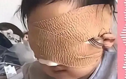 Bé gái 6 tuổi mất cả 2 mắt vì thứ nhiều bố mẹ vẫn cho con chơi mỗi ngày