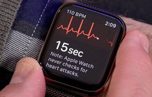 Tính năng "ăn tiền" của Apple Watch sắp sử dụng được tại Việt Nam