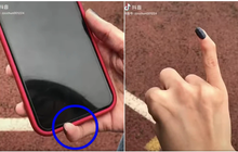 Cộng đồng mạng xôn xao về thói quen cầm điện thoại khiến tay bị biến dạng, sự thật thế nào?