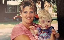 Bé trai sinh ra với ngoại hình kỳ lạ, bác sĩ khẳng định khó sống sót nhưng cuộc đời và diện mạo 17 năm sau khiến ai cũng kinh ngạc