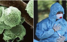 Hết nấm đen, trắng, vàng, giờ người Ấn Độ đang lo bệnh nhân Covid mắc cả... nấm xanh
