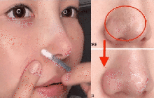 Cách lấy nhân mụn đầu đen tại nhà hiệu quả mà không làm hại da