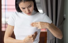 Phát hiện bất thường ở lưỡi, người phụ nữ được chẩn đoán ung thư vú đã di căn, bác sĩ hướng dẫn 3 bước tự kiểm tra