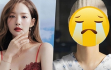 Park Min Young gây choáng khi chỉ còn 37kg, tiều tụy đến không nhận ra