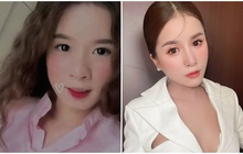 Dung nhan trước khi phẫu thuật thẩm mỹ của Bà Nhân Vlog