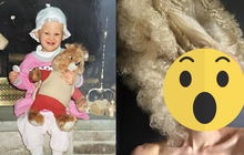 Mắc bệnh hiếm gặp từ khi mới lọt lòng, cuộc sống ở tuổi 33 của cô gái mang vẻ ngoài dị biệt bây giờ ra sao mà ai cũng phải nể phục