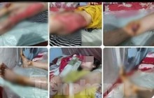 Thực hư tin "con dùng xe máy kéo lê mẹ đẻ trên đường" ở Yên Bái