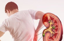 Những sai lầm khi ăn uống khiến thận phải "kêu cứu", ai cũng ít nhất một lần mắc phải