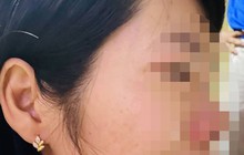 Tình tiết mới vụ phụ huynh đánh cô giáo vì con bị hạnh kiểm trung bình
