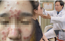 Chi tiền triệu để sở hữu làn da căng bóng, nhận lại khuôn mặt đầy nốt u cục