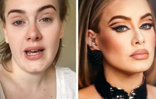 Adele, Lady Gaga tự tin khoe ‘mặt mộc’ nhiều khuyết điểm