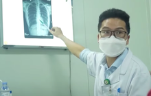 Dịch COVID-19 hôm nay: Ca nhiễm giảm nhẹ