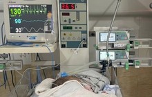 Mắc virus lây qua nụ hôn, trẻ 39 ngày tuổi nguy kịch