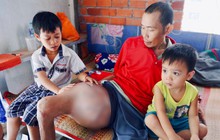 Người cha ung thư xương, ước được sống để nhìn 3 đứa con nhỏ lớn lên