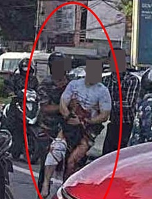 Tiktoker nổi tiếng bị chém đứt bàn tay trên đường: 1 tháng trước từng đăng clip bị truy đuổi, đòi nợ