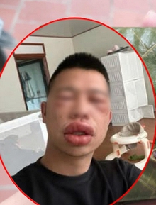 Tết Thanh Minh rủ nhau ăn bánh trứng kiến: Người khen “nổ bôm bốp vui miệng”, người thì… "đổi luôn giao diện" vì dị ứng