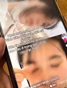 Đã xác minh danh tính nữ sinh "dằn mặt" bệnh nhân, dọa lấy trật ven 3 lần: Hiện đang học tại trường đào tạo y khoa Top 1 cả nước