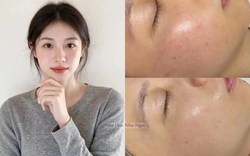 Tôi đã tìm ra cách "bơm" collagen cho da căng mướt, tới độ không ai ngờ tôi đã 35 tuổi