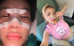 Ngân 98 lạm dụng phẫu thuật thẩm mỹ, hệ quả ra sao?