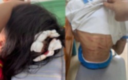 Bé gái lớp 5 nghi bị bố dượng bạo hành đã mở cửa sổ cầu cứu hàng xóm: Thêm loạt chi tiết gây phẫn nộ