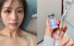 Tôi bất ngờ vì dùng serum collagen kèm cây lăn kim, ban đầu hơi sợ nhưng càng dùng lại thấy da càng đẹp