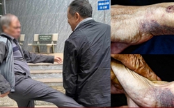 Người đàn ông dọa "giết cả nhà" hàng xóm, cư dân tòa nhà hoang mang