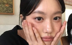 Da xỉn màu, nhợt nhạt đầu mùa lạnh: Đều do sai lầm hội U35 hay mắc