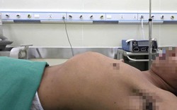 Thanh niên bị "bệnh lạ", tỉ lệ 1/1.000 người mắc