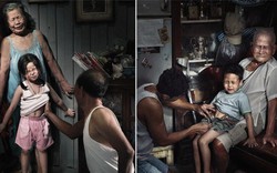 Bộ ảnh gây chấn động: "Nỗi đau theo suốt một đời"