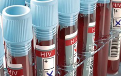 Người phụ nữ nhiễm HIV dù chồng và con gái không hề mắc bệnh: Phân tích virus cho kết quả gây sốc
