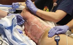 5 thử thách TikTok cực nguy hiểm, có một thử thách từng giết chết hơn 100 người