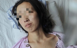 Đi khám vì khó tiêu, người phụ nữ phát hiện ung thư gan: BS hoảng hốt: "Ai lại ăn sáng kiểu này suốt 20 năm?"