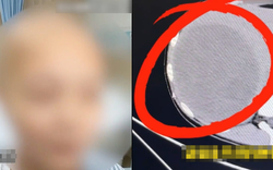 Bé gái 15 tuổi phát hiện khối u to bằng nửa lá gan, bác sĩ tức giận: Ai lại coi món này là bữa chính!