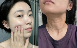 5 vùng da lão hóa nhanh nhất mà 90% chị em đều bỏ quên, nhìn vào dễ tưởng là người già